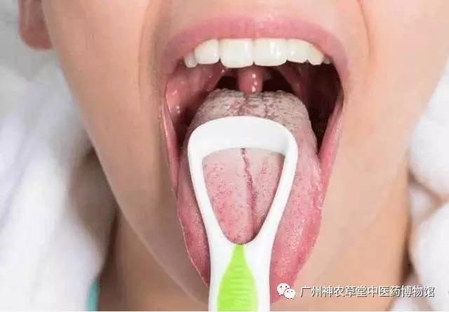 舌头上的脏东西需要每天清洁吗,舌头发白是口腔粘膜损坏吗