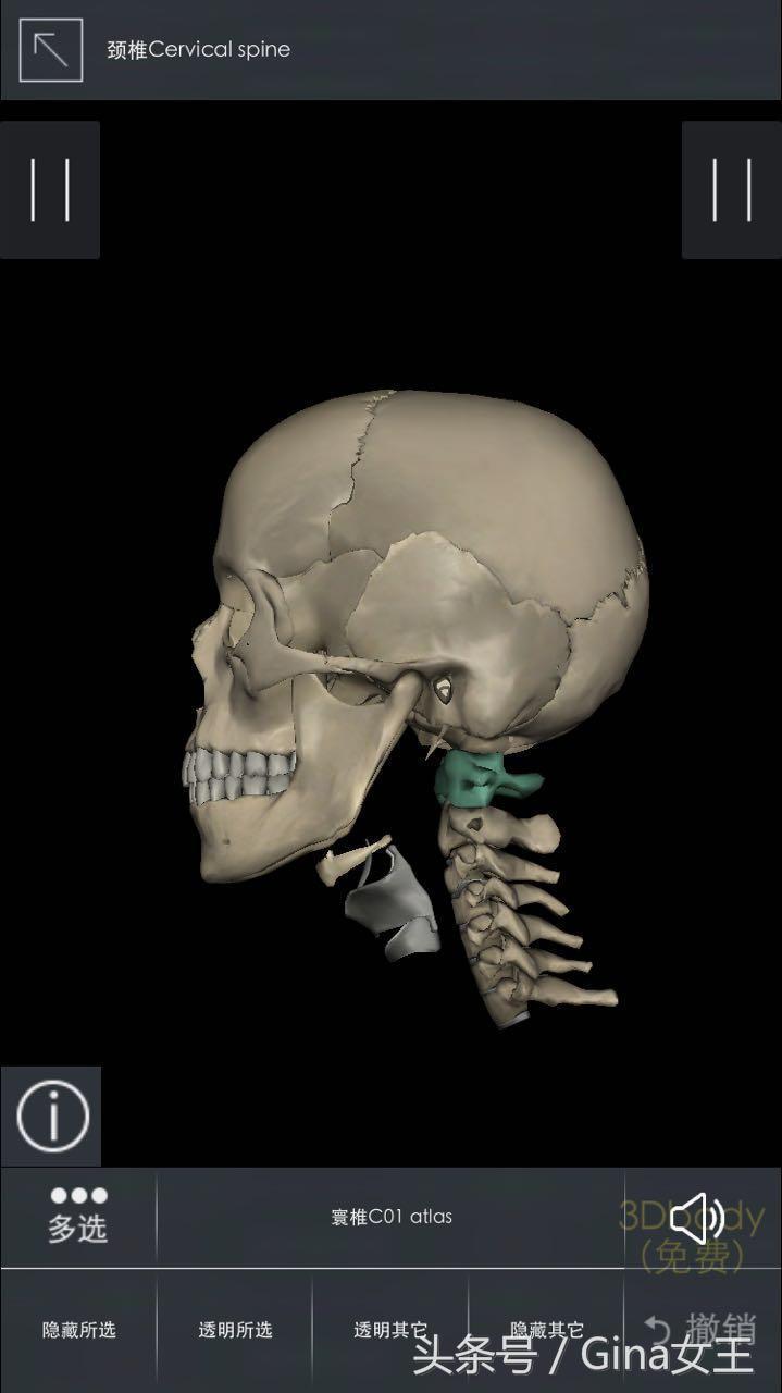 低头族脖子弯了怎么矫正,低头族脖子僵硬训练缓解