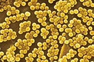 30岁之后关节会快速退化，有这6个习惯的人一定要小心！