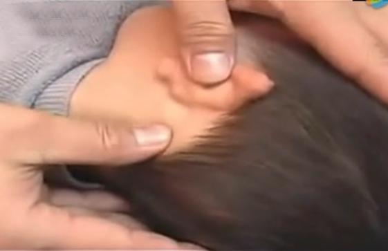 湘西点穴治疗脑瘫的名医,小儿脑瘫推拿疗法