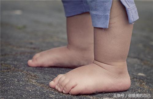 痛风最简单的远离方法,痛风后悔的十大习惯