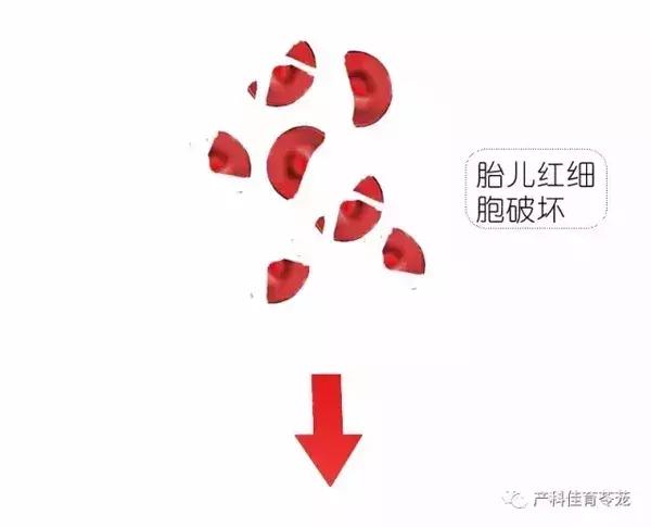 熊猫血女性是不是怀了容易流产,熊猫血的女人是不是很难受孕