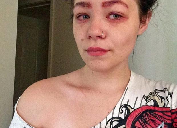 女子用了一支新眉笔后几乎致盲！