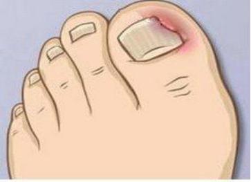 李茜心理学专家谈看病,李茜心理学专家1号课