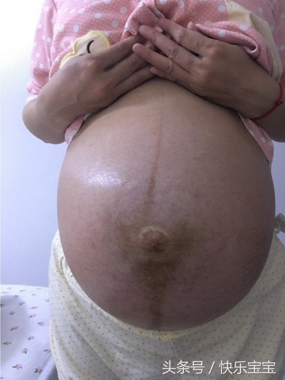 孕妇产检小孩入盆是快生了吗,宫口开了一指胎儿是不是入盆了