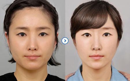 婴儿肥减肥能瘦下来吗,婴儿肥能通过运动瘦下来吗