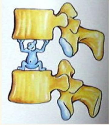 20岁腰椎间盘突出可以完全康复吗,关于腰椎间盘突出你需要知道的