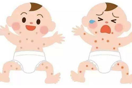 春季湿疹高发，宝宝预防湿疹注意点啥？