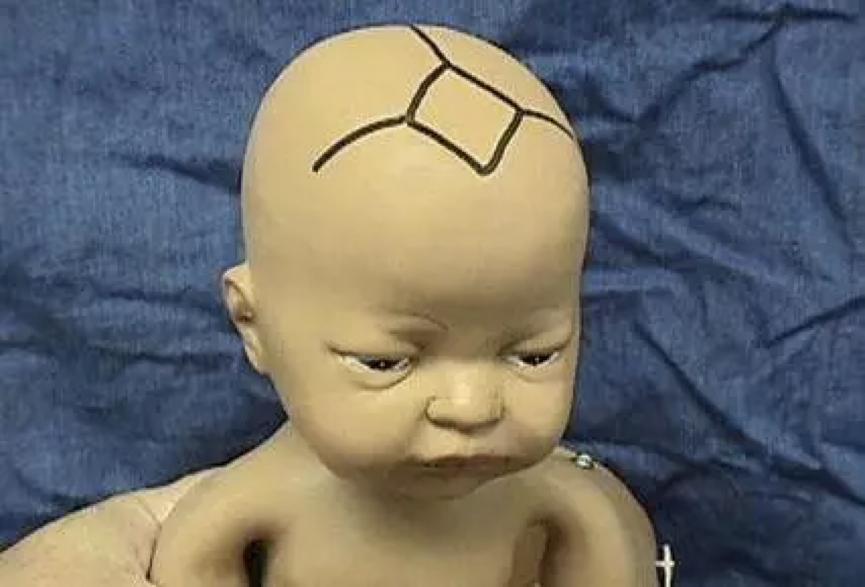 宝宝感冒了晚上睡觉鼻塞怎样缓解,秋冬季节宝宝总是感冒鼻塞怎么办