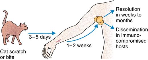 有没有被猫抓过，那你可要留意一下这个皮肤病了，猫抓病