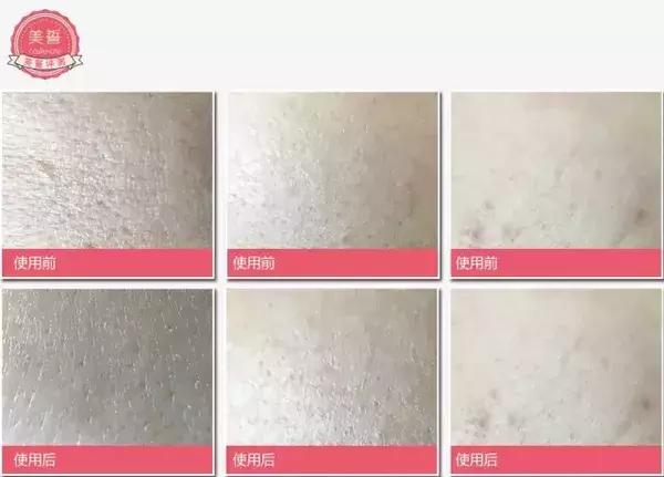 关于面膜的作用你要知道的,你不知道的食物面膜