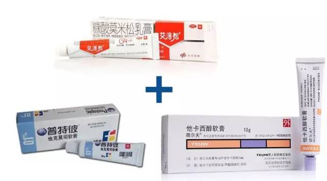 治疗银屑病最新的生物制剂,推荐银屑病特效药膏