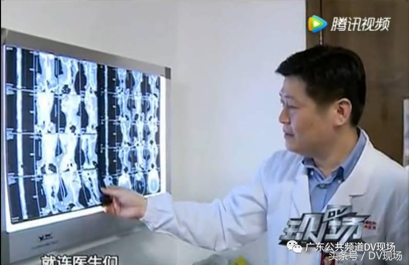 颈动脉堵塞会引起呼吸困难吗,颈动脉血管堵塞60%严重吗