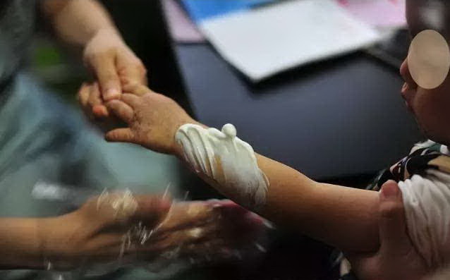 肤乐霜到底值不值得买 (为什么肤乐霜这么难买)