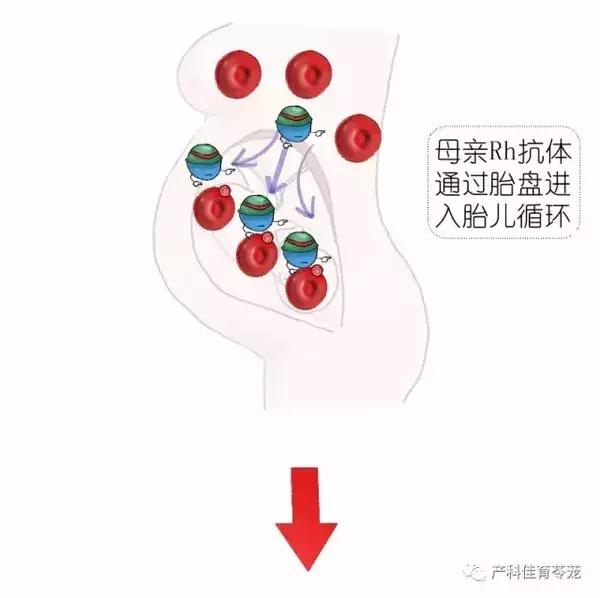熊猫血女性是不是怀了容易流产,熊猫血的女人是不是很难受孕