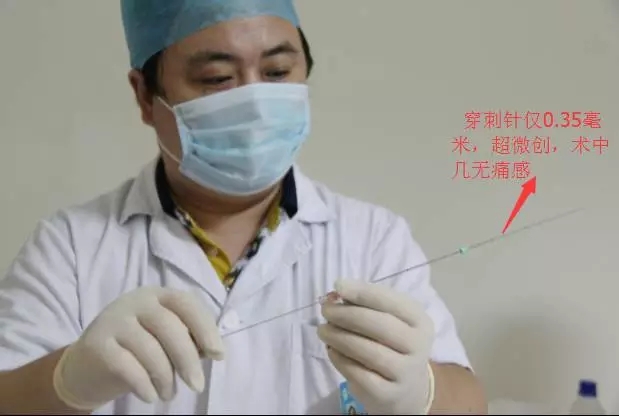 巨大肝囊肿怎么治疗杭州,巨大肝囊肿病例