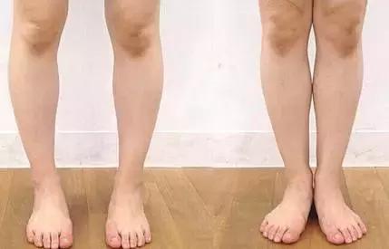 30岁之后关节会快速退化，有这6个习惯的人一定要小心！