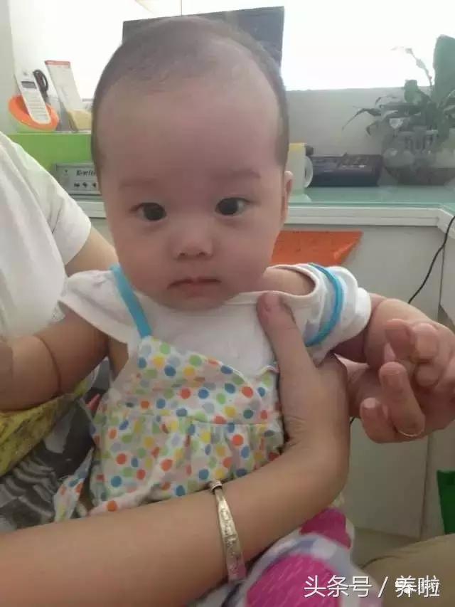 宝宝头发稀少怎么办视频,宝宝头发稀少怎么办还掉发