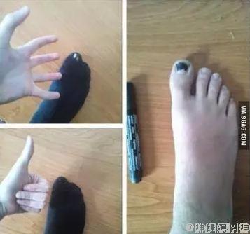 袜子破个洞怎么补救视频,袜子破了个洞怎么办