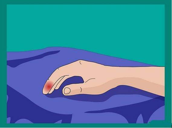 连这种痛都没经历过，都不好意思说你打过球！高手的必修绝技！