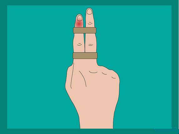 连这种痛都没经历过，都不好意思说你打过球！高手的必修绝技！