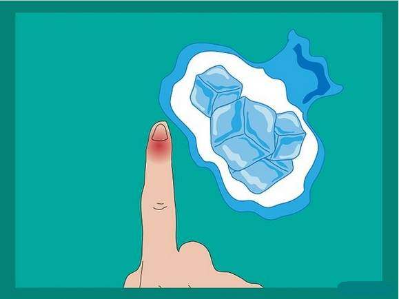 连这种痛都没经历过，都不好意思说你打过球！高手的必修绝技！