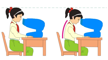 斜视伴随弱视该如何治疗,发现孩子弱视怎么办