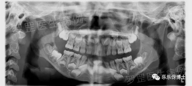 宝宝为什么喜欢张大嘴笑,小宝宝为啥抿着嘴笑