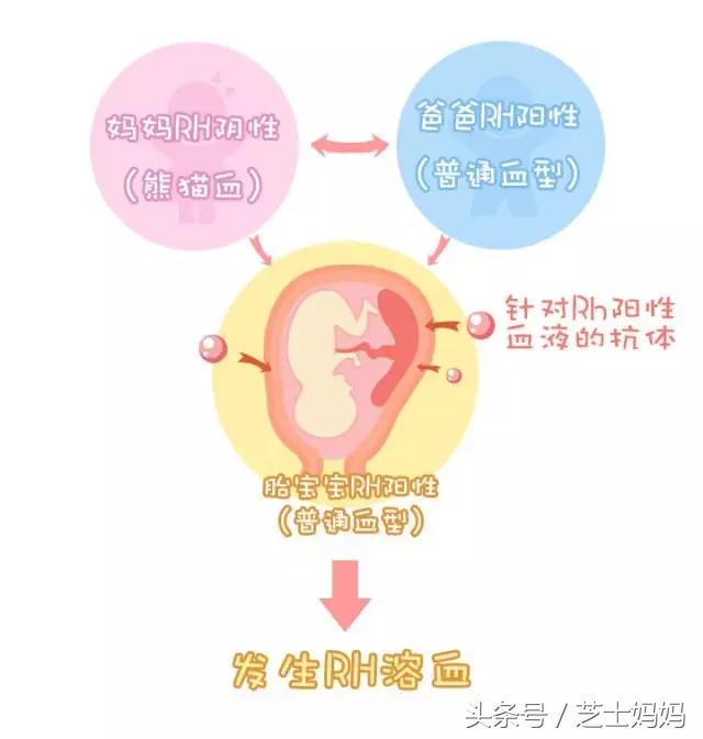 朋友圈熊猫血,熊猫血生娃需要注意什么
