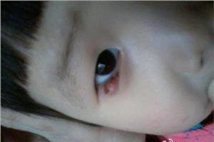 宝宝长倒睫毛，宝妈别再瞎剪了，这样做不对的
