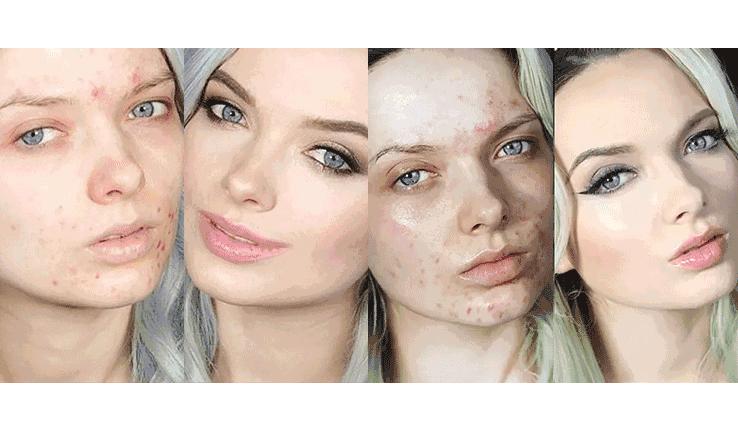 皮肤不好有哪些疾病,对皮肤不好的3种习惯