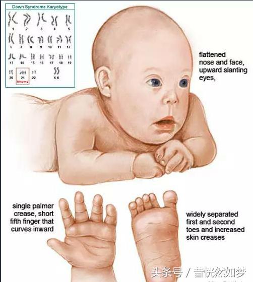 唐筛有问题医院会提前通知你吗,唐筛有问题再做无创还是羊水穿刺