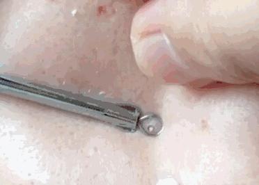 皮肤不好有哪些疾病,对皮肤不好的3种习惯