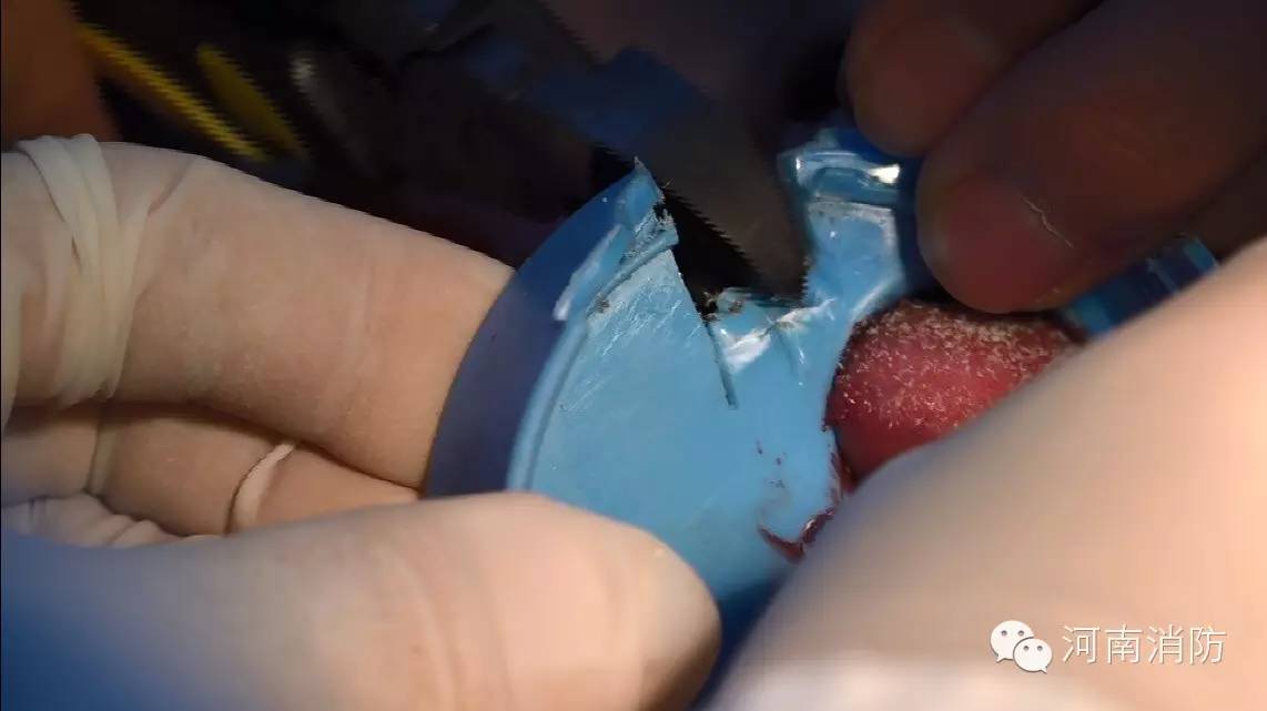 心疼，女童舌头被卡痛的哇哇大哭，只因喝水的时候做了这个动作！