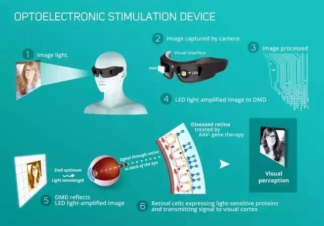 眼睛黄斑病变会遗传下一代吗,遗传性眼病视网膜色素变性