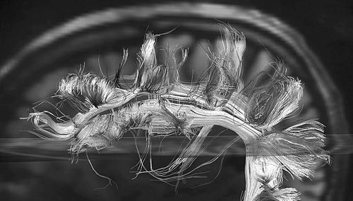 大脑袋有主机吗,大脑袋要账可以吗