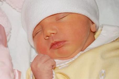 新生儿4天黄疸指数15,新生儿黄疸指数多少正常