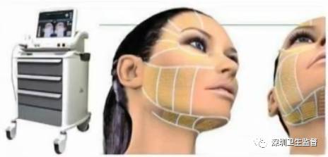 超声刀抗衰老美容仪,抗衰老医美超声刀