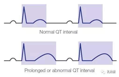 qt和qtc间期正常值范围,qtc间期