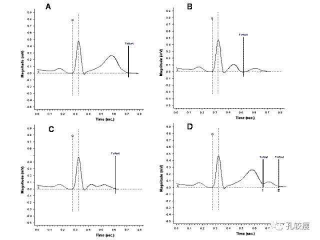 qt和qtc间期正常值范围,qtc间期