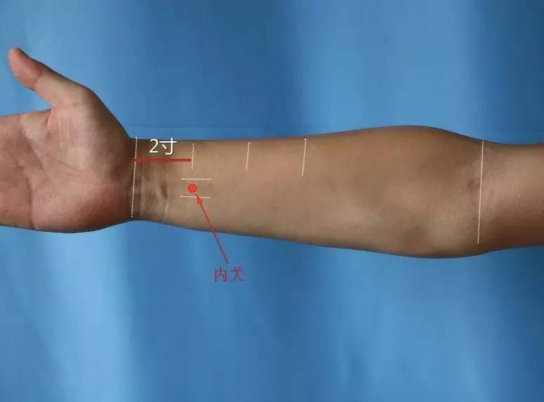 心梗疼痛打止疼针有用吗,心梗中医扎针治疗方法