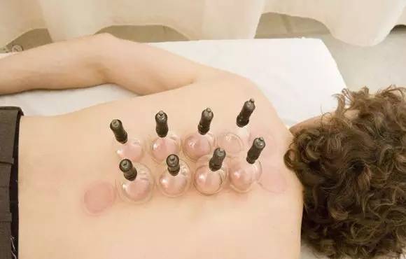 自己在家拔罐减肥的正确方法,拔罐减肥和埋线减肥哪个好