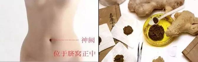 心梗疼痛打止疼针有用吗,心梗中医扎针治疗方法