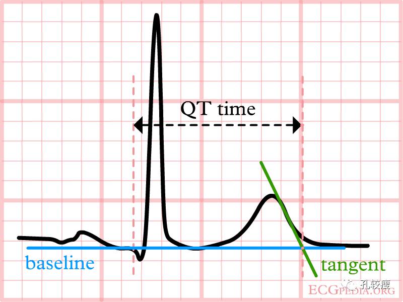 qt和qtc间期正常值范围,qtc间期