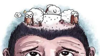 发际线越来越高掉发怎么办,发际线越来越高怎么办