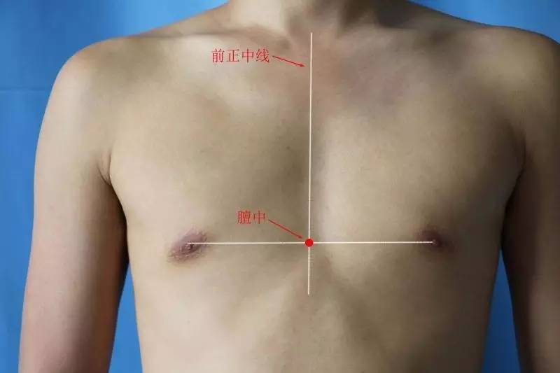 心梗疼痛打止疼针有用吗,心梗中医扎针治疗方法