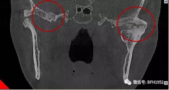 北京友谊医院颞下颌关节科,北京友谊医院手术单