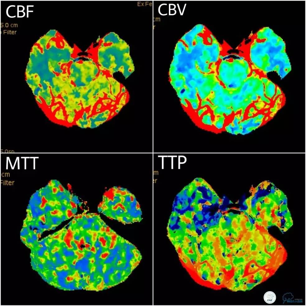 天坛椎动脉狭窄,天坛周记