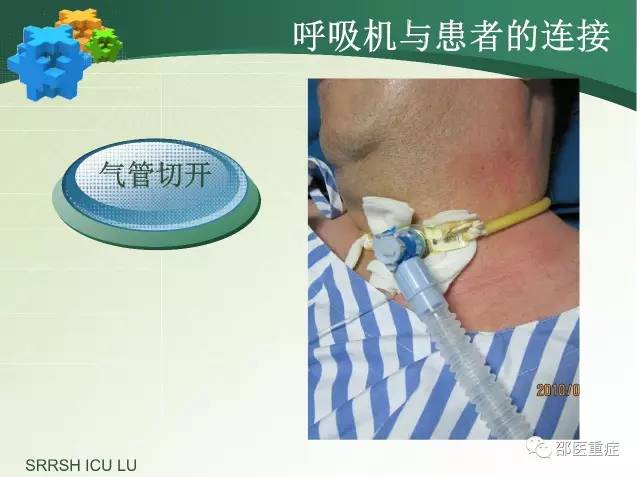 有创机械通气操作,机械通气英文缩写