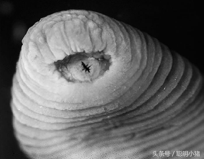 哪些生物可能爬进你体内？